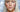 How to make acne a thing of the past