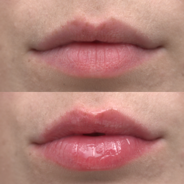 PLUMP UP THE VOLUME - LIP PLUMPER & PREP